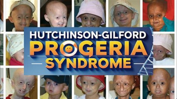 
What Was Gilford Godfrey Illness? Death Age 67, Did He Have Cancer? 